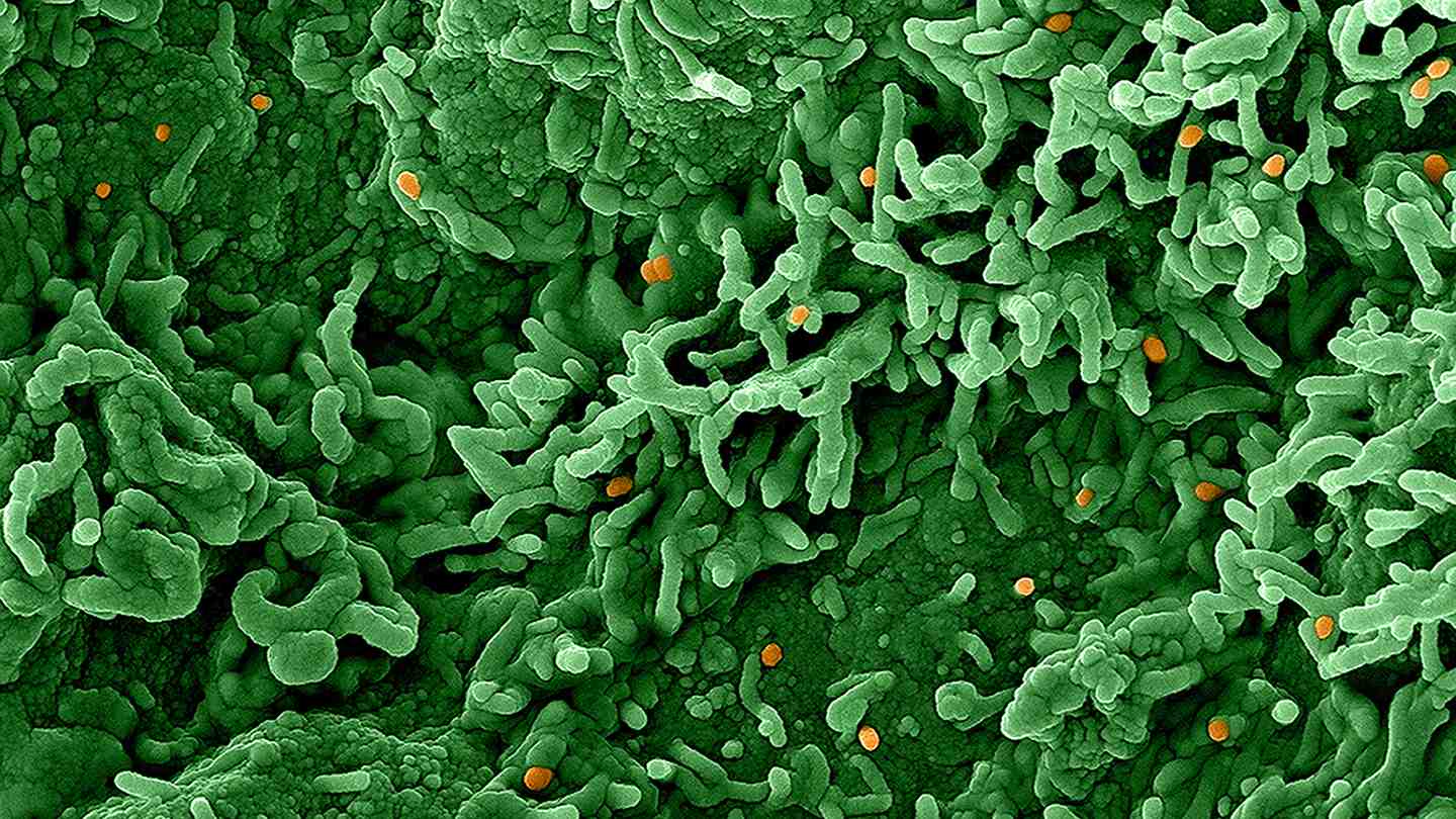 Does the smallpox vaccine protect against monkeypox?