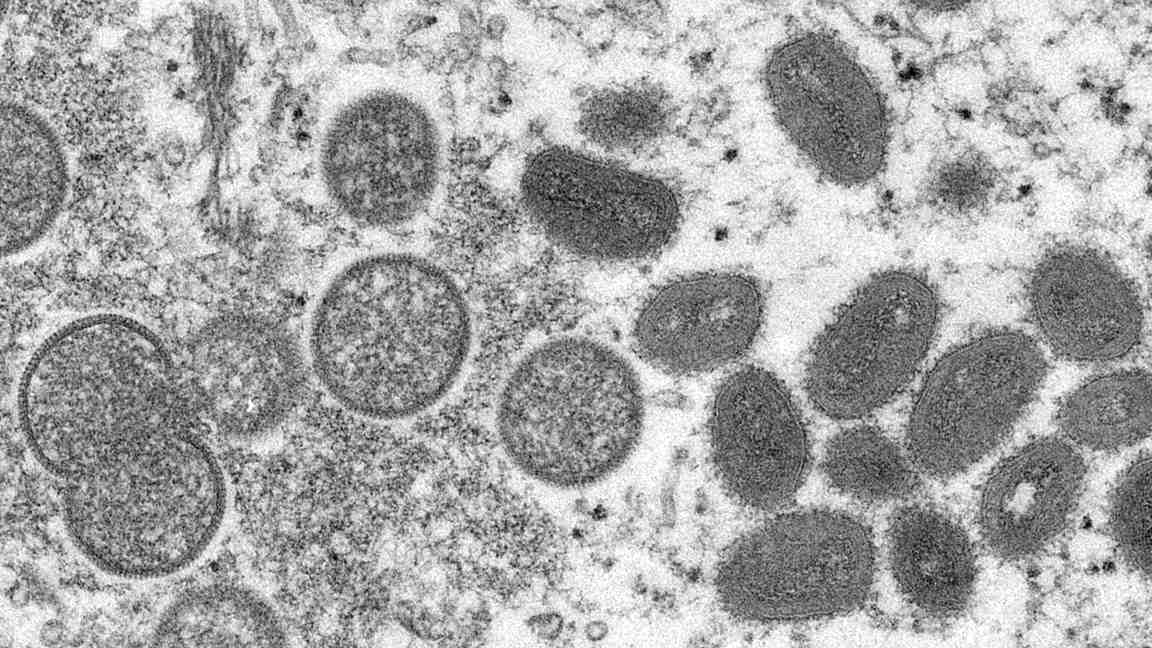 How many cases of monkeypox are in 2022?
