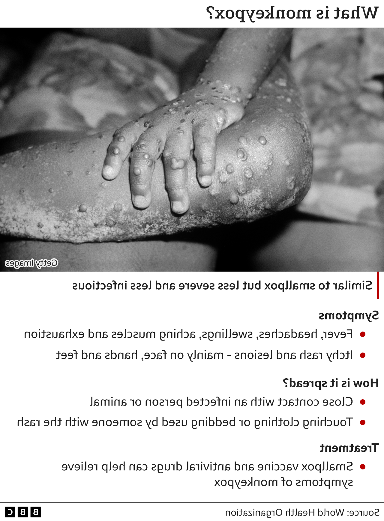The monkeypox treatment